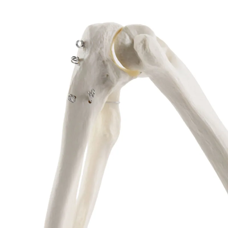 Adult Human Upper Limb Bone Arm and Radius Hand Bone Anatomy Model Medical Science Classroom Supplies Teaching