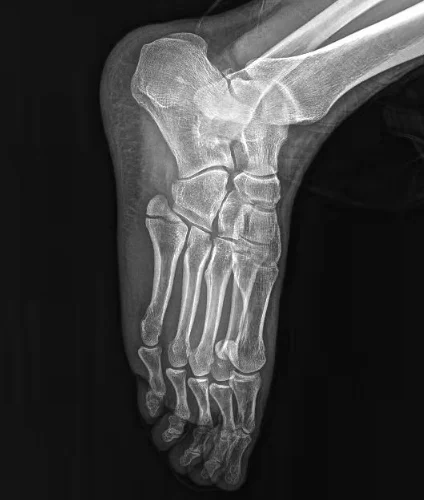 Рисунок 4 - Ветеринарный и человеческий FPD