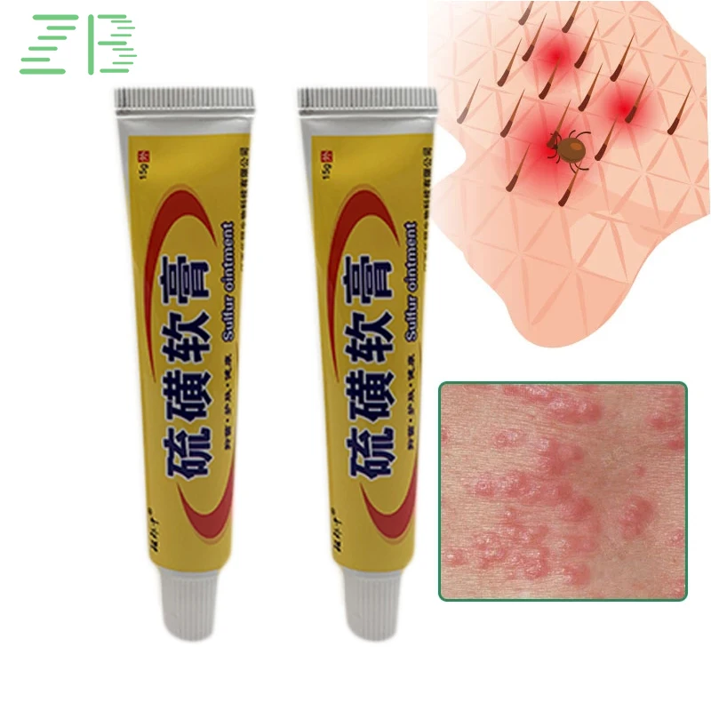 15g Sulfur Antibacterial Cream Itching Relief Ointment Suitable for Mite Bites Dry Itchy Fungal Infection Remove Medical Plaster