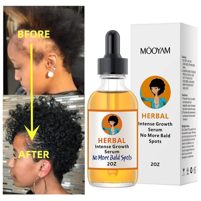 Black Seed Castor Oil Hair Growth Serum For Thick Hair Fast Growth