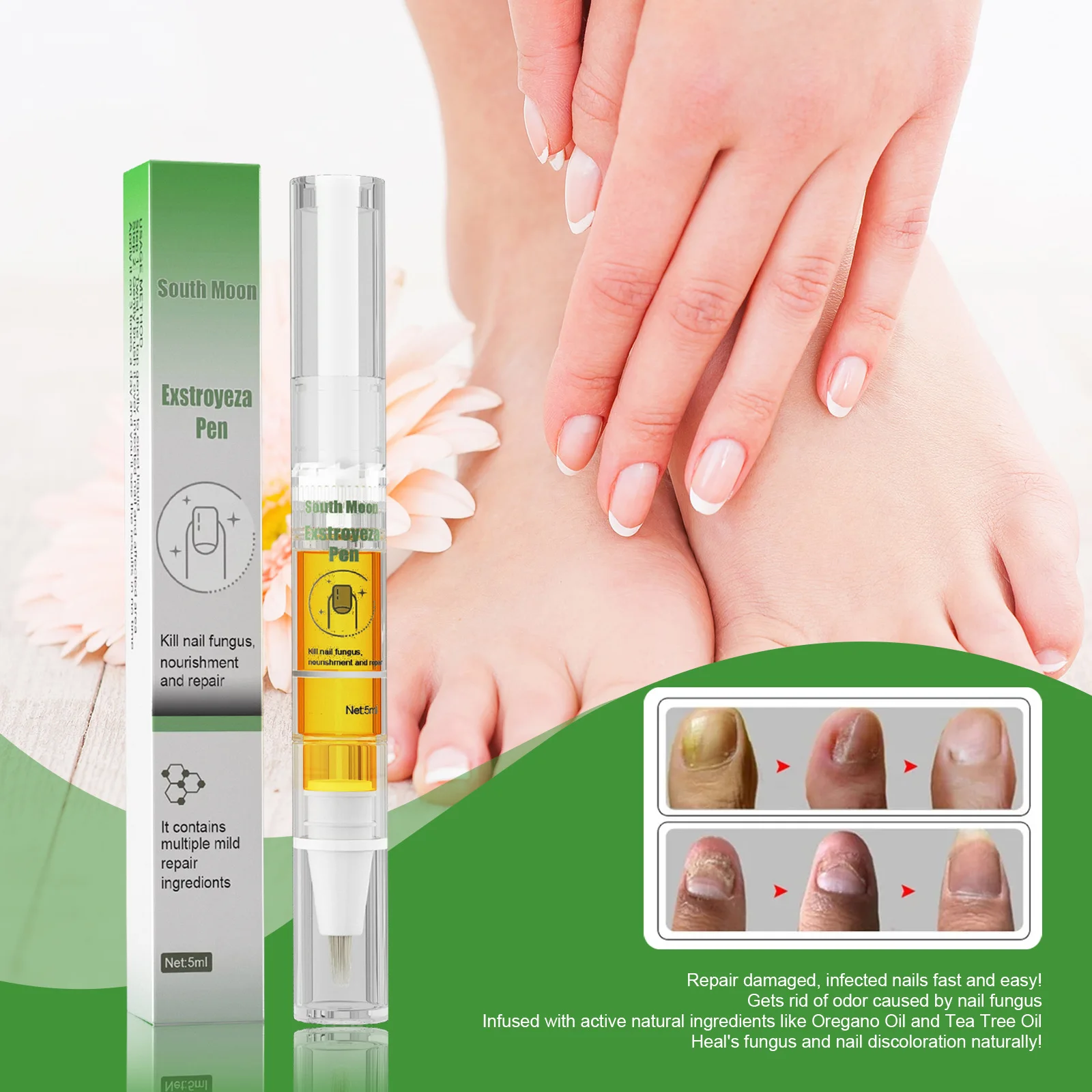

Fungal Nail treatment Repair Essence serum Fungus Removal oil Anti Infection Paronychia Onychomycosis Repair foot care Liquid