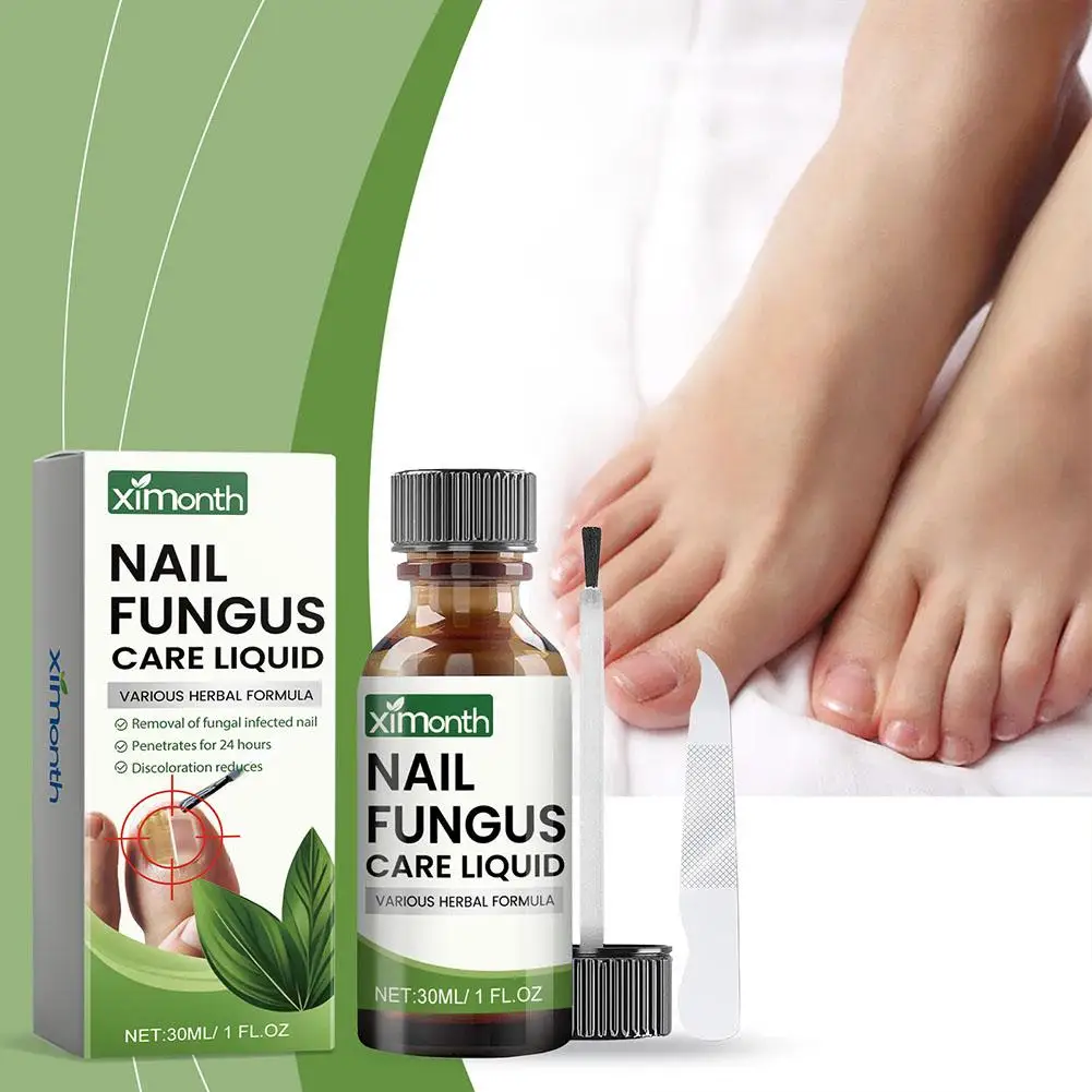 Onychomycosis Hand Foot Treatment Serum 5pcs 50g
