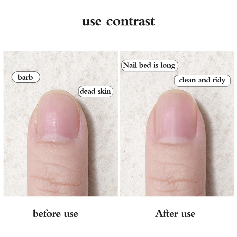 

1 шт., V-образная вилка для удаления кутикулы