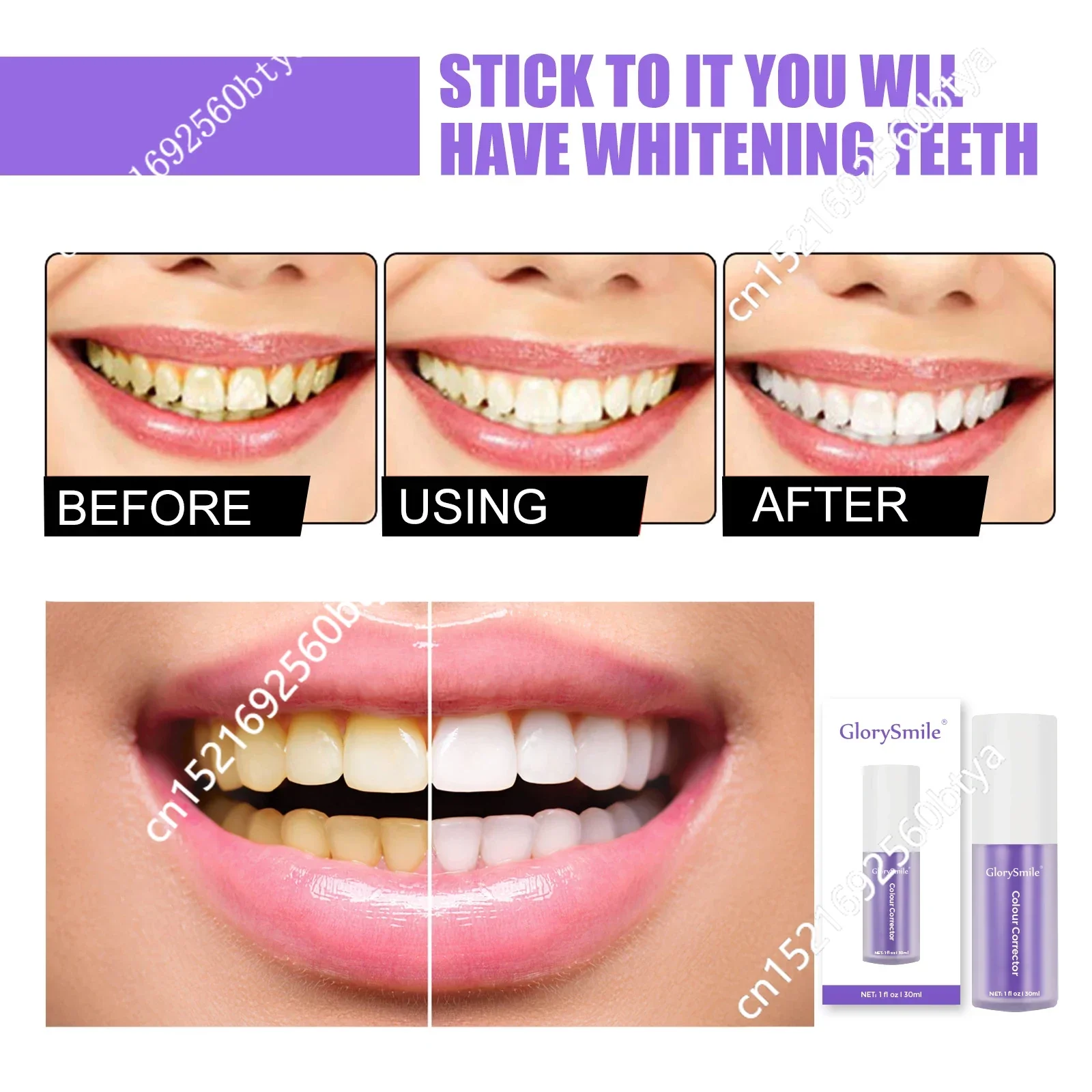 

Профессиональный отбеливатель зубов, отбеливание зубов, отбеливание зубов