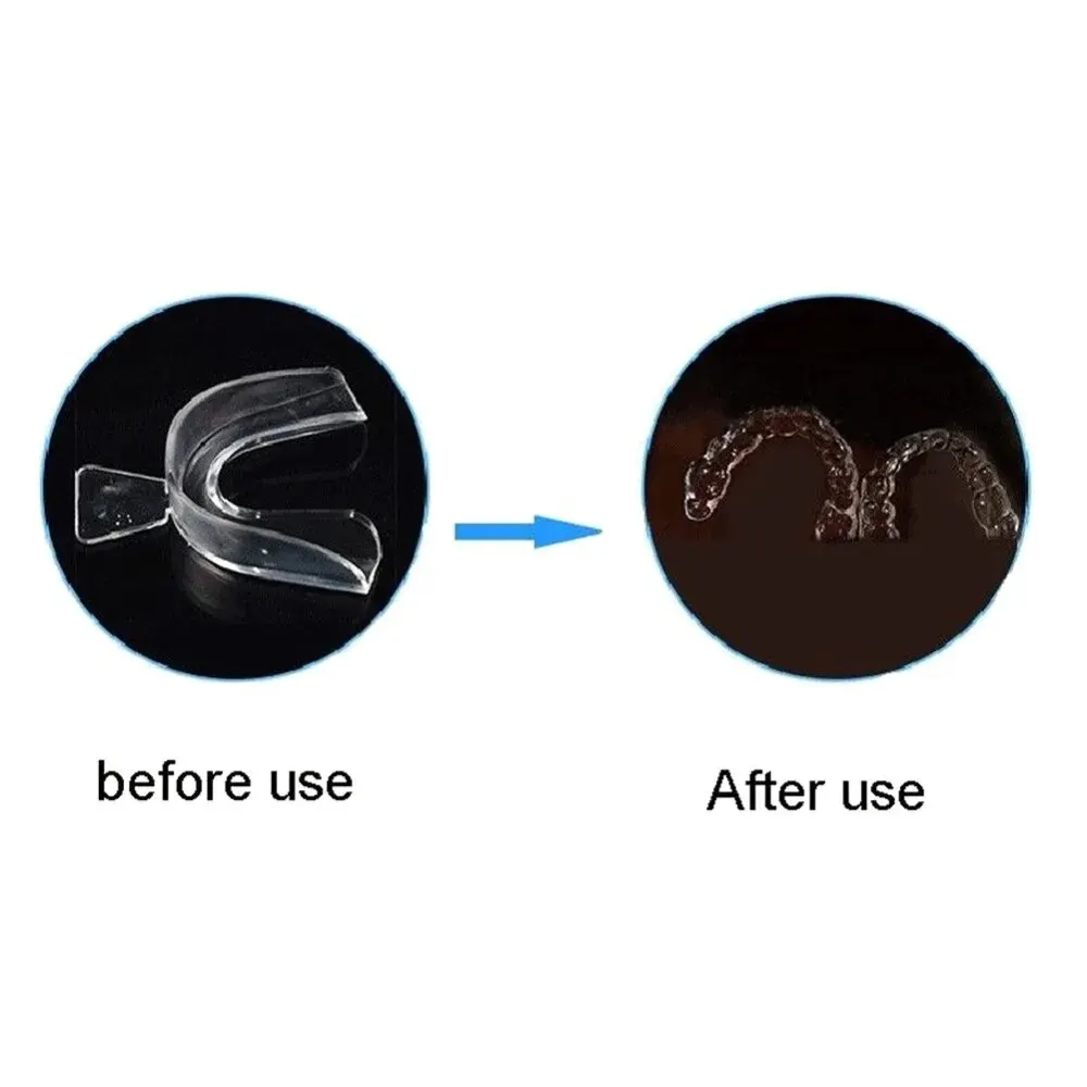 Teeth Whitening Braces 2-piece Teeth Tray Whitening Braces For Oral Hygiene Care Bleaching Teeth Tools