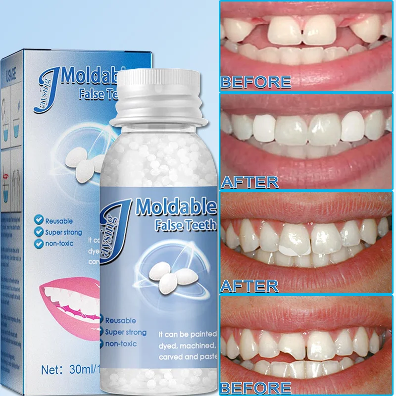 1PC Temporary Tooth Repair Kit False Teeth Solid Glue Denture for Missing  Broken Teeth Moldable Tooth Filling False Teeth Tool - AliExpress