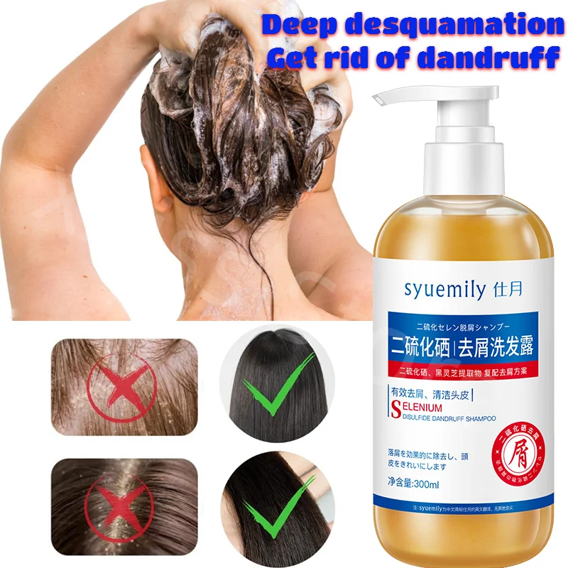 Deep Anti-dandruff Shampoo Oil Removal Antipruritic Deep Maintenance Shampoo Refreshing Oil Control Get Rid of Dandruff