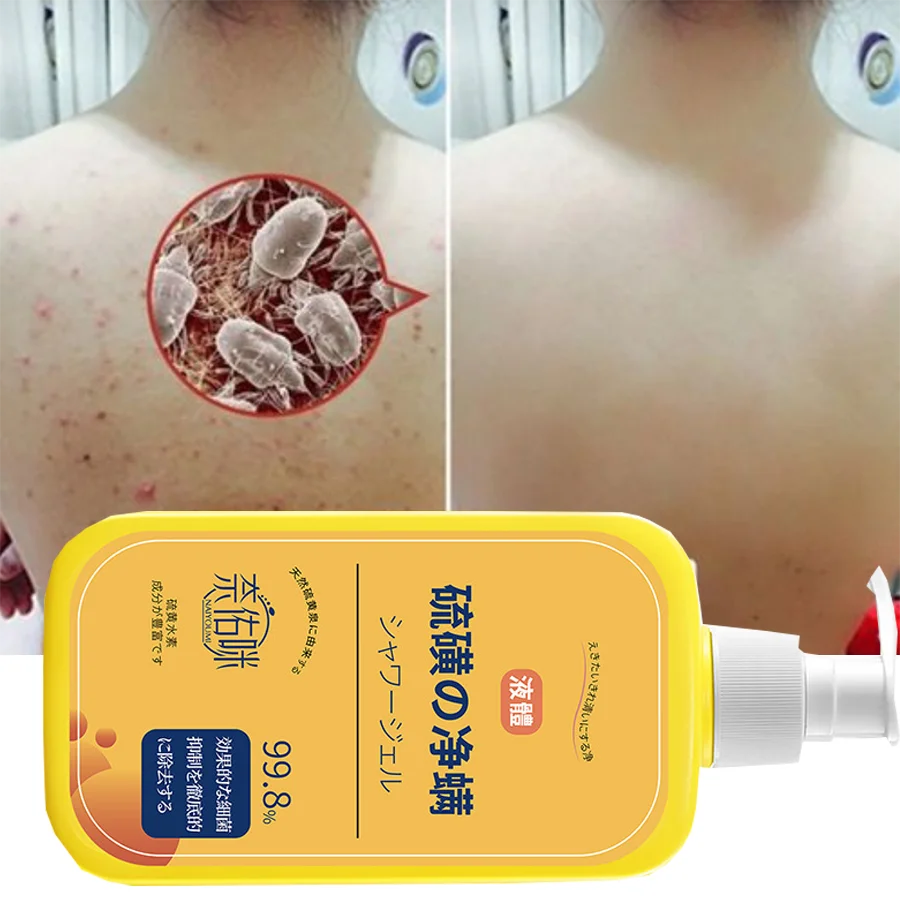Shower Gel 400ml Sulfur Liquid Mite Removal Soap Cleaner Bar Soap Acne Treatment Reduce Oil Keeps Pores Cleaner Hand Sulfur body wash