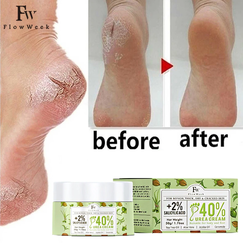 Flow Week Vitamin E Urea Cream Skin Care Cream Urea 40% Foot Cream Callus Remover Foot Moisturizer Corn Callus Dead Skin Remover