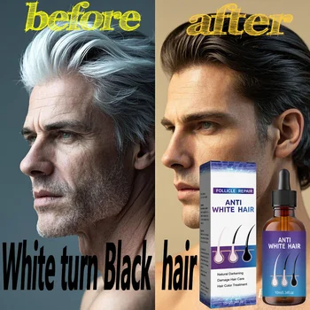 Essenza per capelli anti-grigio Giro bianco Nero Migliora la struttura Rafforza le radici Capelli più spessi e più sani Riduce la salute dei capelli grigi