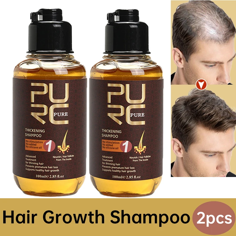 Purc 2 Pcs Ginger Hair Growth Shampoo Product Cleaning Scalp Oil