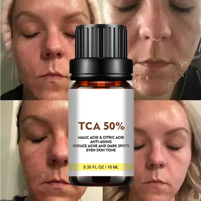 Salicylic acid facial serum Salicylic Acid Face Facial Peel Neutraliser Face Deep At Home Chemical Peel Exfoliate Refine skin care serum