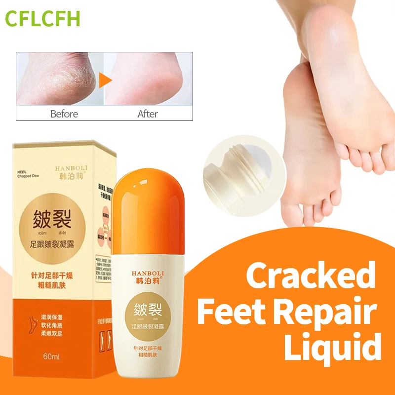 

Крем против трещин для ног, восстанавливает поврежденную кожу