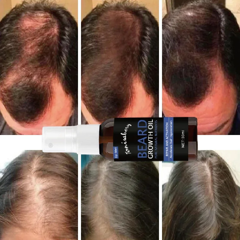 Beard Growth Serum Spray Fast Styling Hair Growing Essential Oil Thicker Longer Fuller Beard Softening Moisturizing Liquid hair growth serum hair growth spray