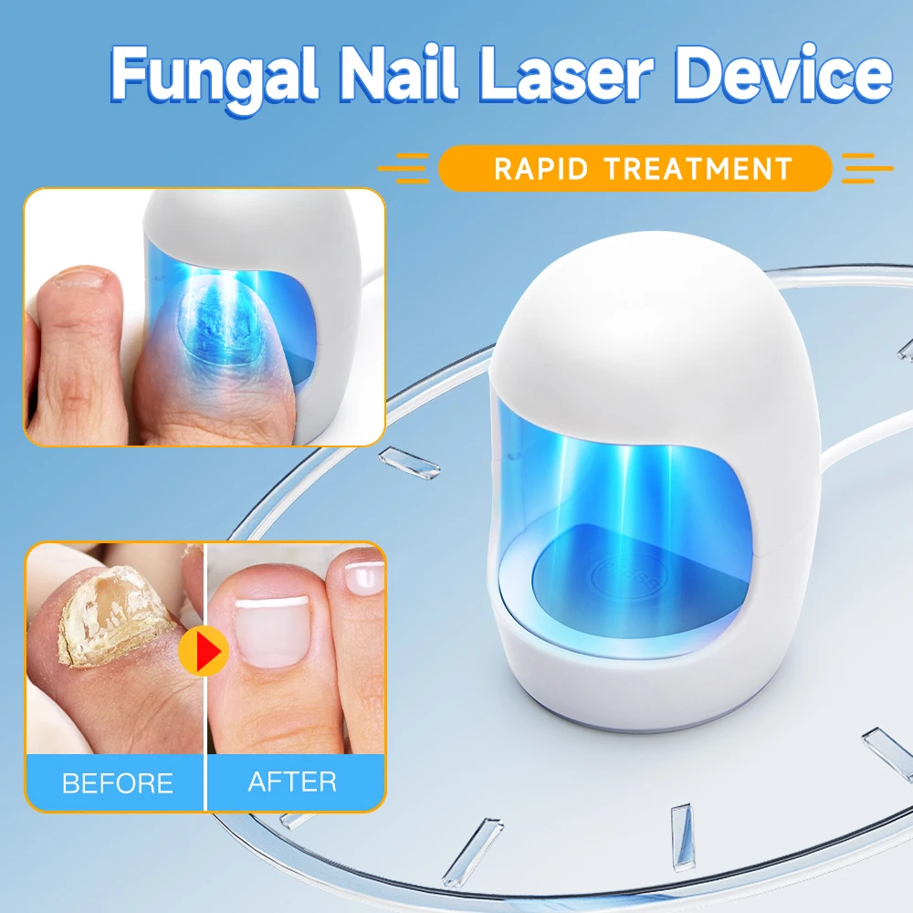 Nail Fungus Cleaning LED Device for Toenails & Fingernails