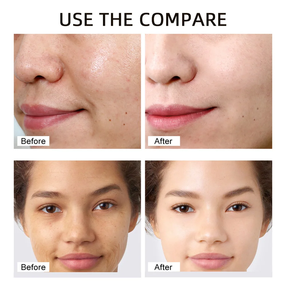 الكورية الحلزون Mucin الكولاجين قناع الوجه إزالة ا...