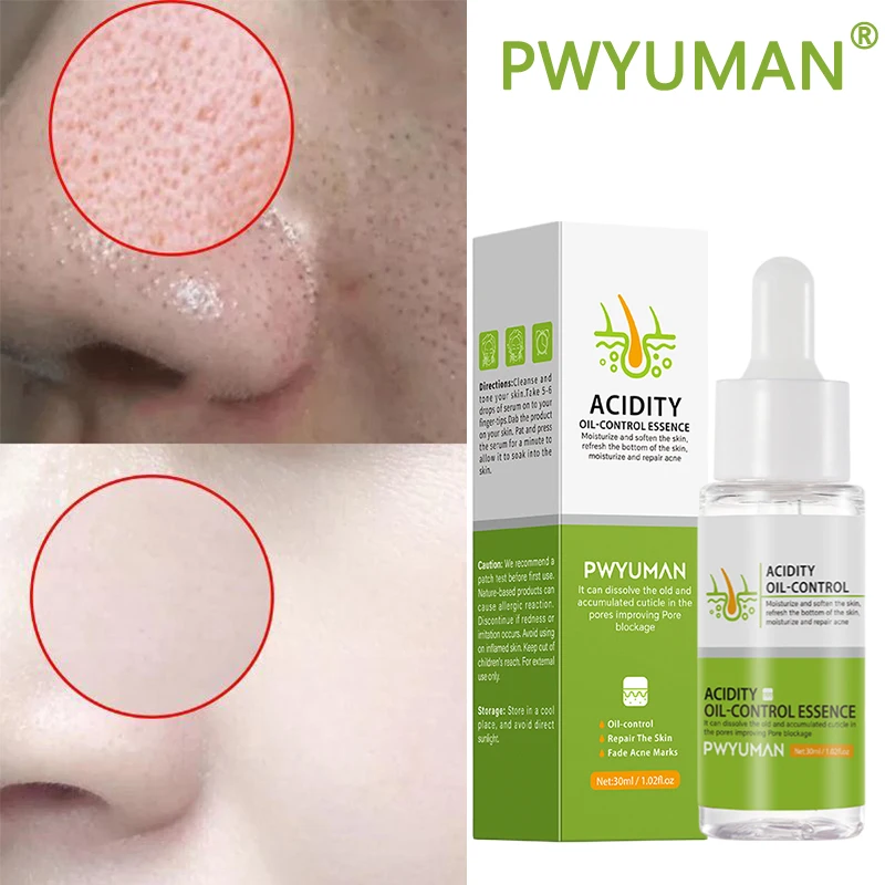 

Salicylic Acid Pore Shrinking Serum Acne Pimple removal Oil Control Smooth Facial Moisturizer Whitening Korean Skin Care 30ML