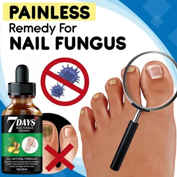 7DAYS Nail Fungus Treatment Essence Serum Care Hand and Foot Care Removal Repair Gel Anti-infective 2