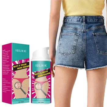 Crema per l'acne per glutei e cosce Rimuovi brufoli Idratante Chiarificante Schiarente Levigante Cura della pelle Crema per la rimozione dell'acne per coscia 1
