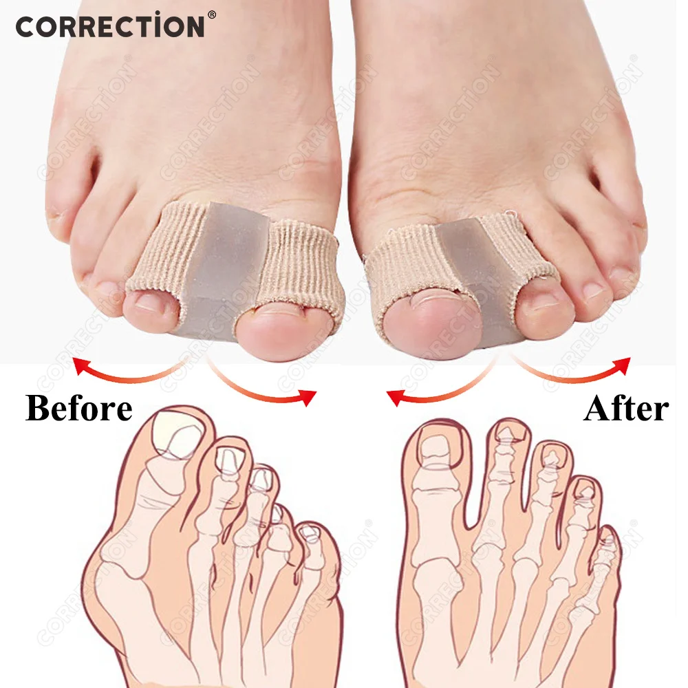 

2 holes Toe Separator Finger Feet Care Protector Silicone Toe Orthopedic Products Bunion Corrector Hallux Valgus For Pedicure