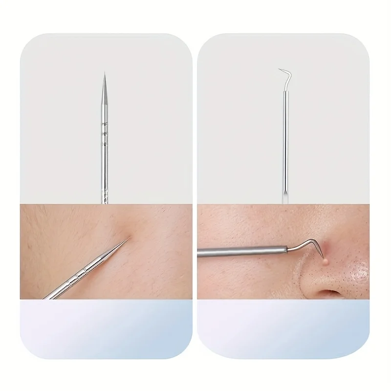 Stainless Steel Acne Tool Kit 2