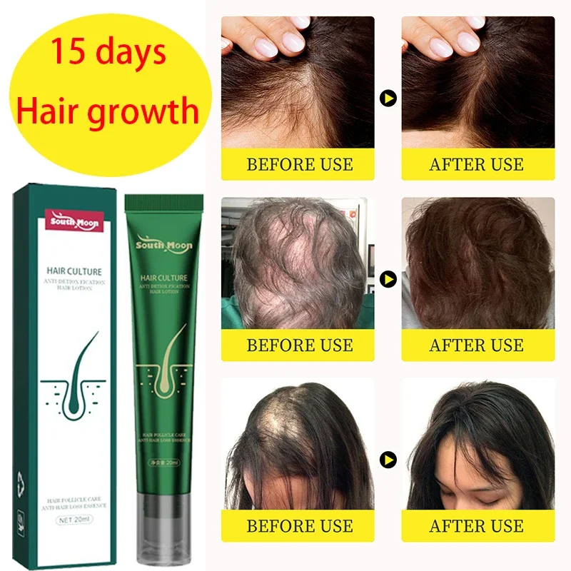 

Unisex Hair Growth Oil Hair Loss Treatment Rapid Hair Growth Effective Baldness Repair Hereditary Postpartum Hair Loss