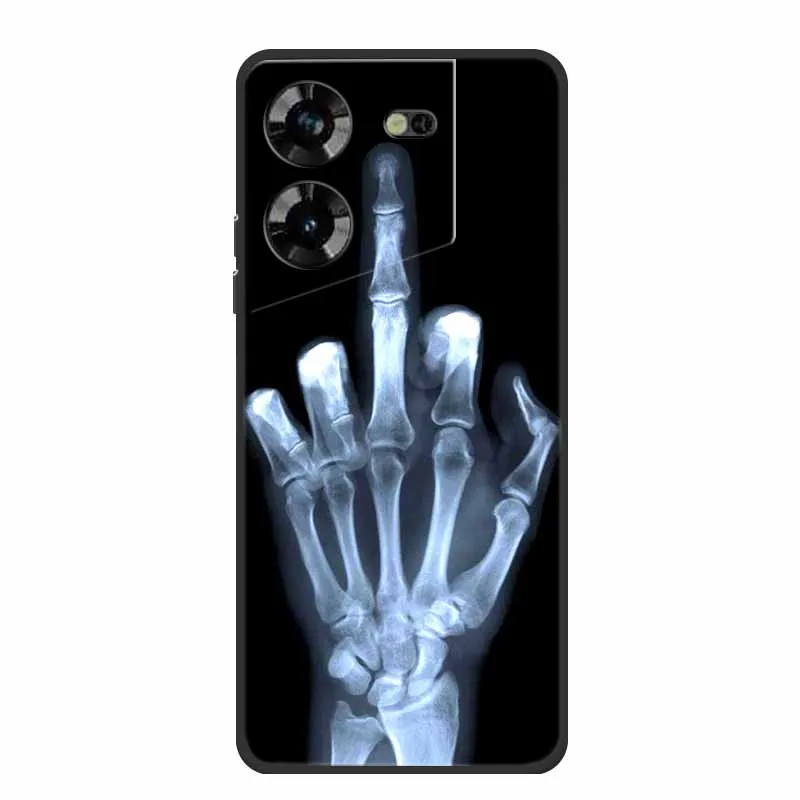 Fashion Soft TPU Silicone Shockproof Bumper Phone Case