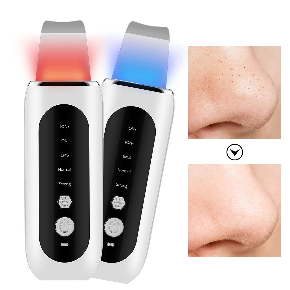 Ultrasonic Facial Skin Scrubber