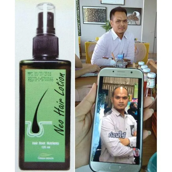 Original Thailand Neo Hair Lotion Anti-Hair Loss Tonic Hair Treatment Solution 120ml hair growth serum hair growth cream hair growth spray
