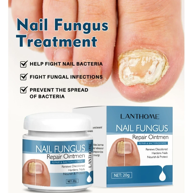 

LANTHOME Treatments Cream Oil Feet Care Repair Serums Toe Drop Shipping