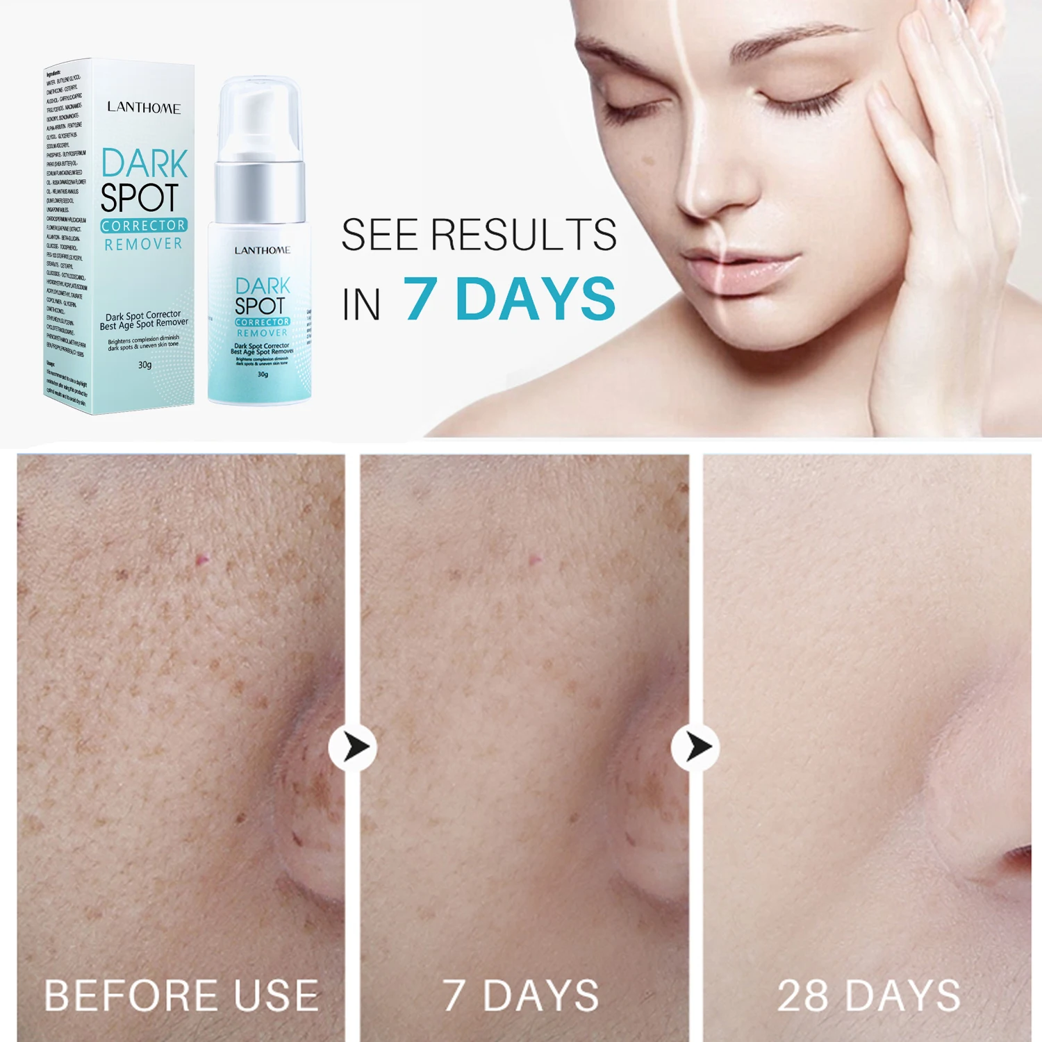 Lanthome Dark Spot Cream Remover Corrector Expel Toxins From Pores, Whiten And Moisturize, Improve Skin Barrier 30g - Day Creams & Moisturizers - AliExpress