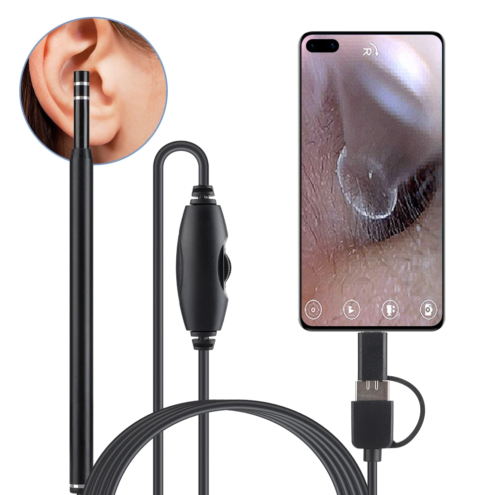LED HD 내시경 검이경 포함 비주얼 귀이개, 귀지 청소, 구강 검사 지원, 안드로이드 시스템 컴퓨터, 5.5mm
