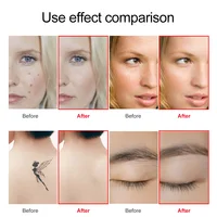 Lescolton LS-831 Silver / LS-830 Gold / LS-058 Facial Skin Care Beauty Device For Face  Body Skin Tags Removal Dropshipping 2