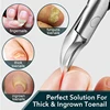 1Pcs Nail Clippers Professional Thick Ingrown Toenails Cutters Sharp Curved Blade Seniors Pedicure Tool 3