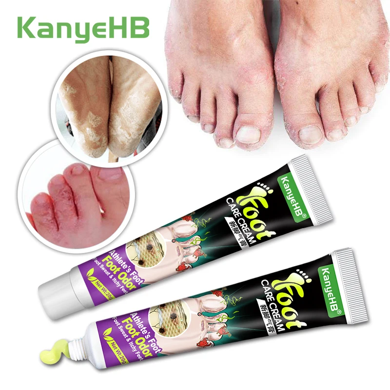 

2pcs Beriberi Ointment Solve Foot Fungal Infections Anti-itch Cream Treatment Blisters Feet Peeling Remove Odor Foot Cream A1283