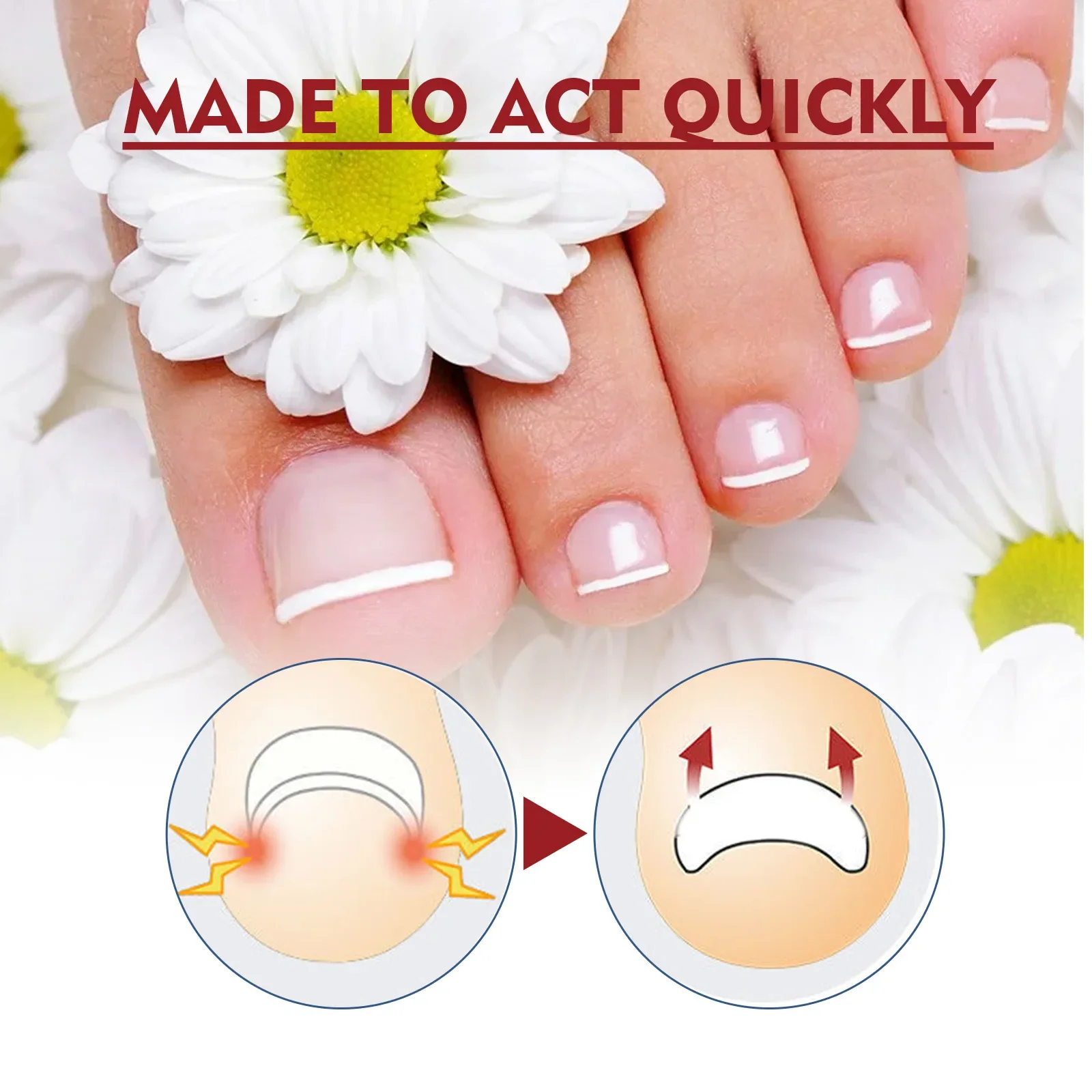 10ml Paronychial Sulcus Nursing Oil Repair Ingrown Armor Grey Nails Paronychial Sulcus Relieve Soft Armor Bright 발톱무좀