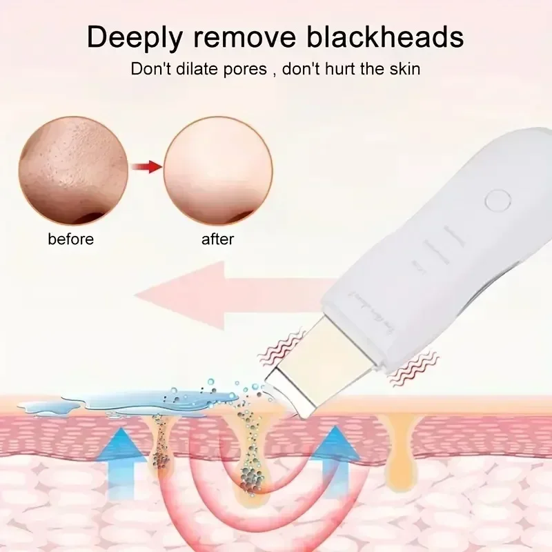 Facial Scrubber Deep Vibrate Skin Shovel Spatula Blackhead Remover