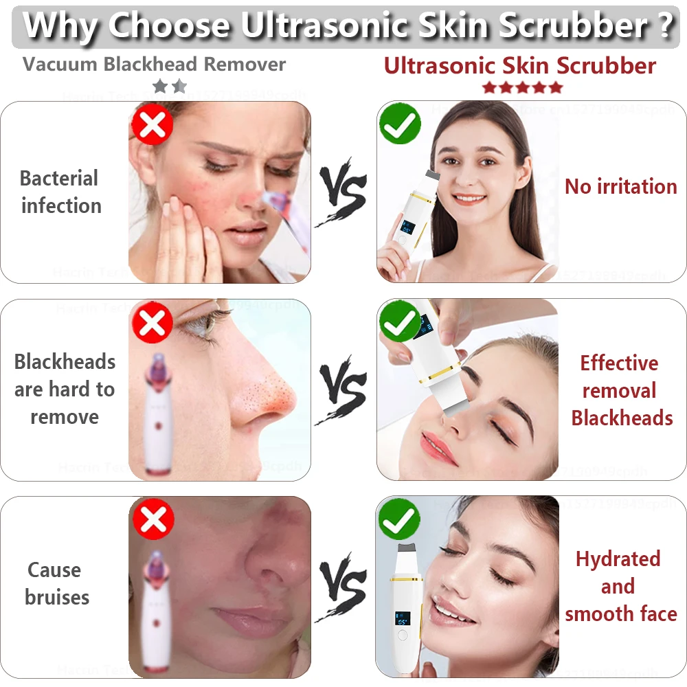 Ultrasonic Skin Scrubber Remover Blackhead Ultrasonic Peeling Facial Scrubber Shovel Ion Deep Cleaning Remove Pore Acne Cleanser