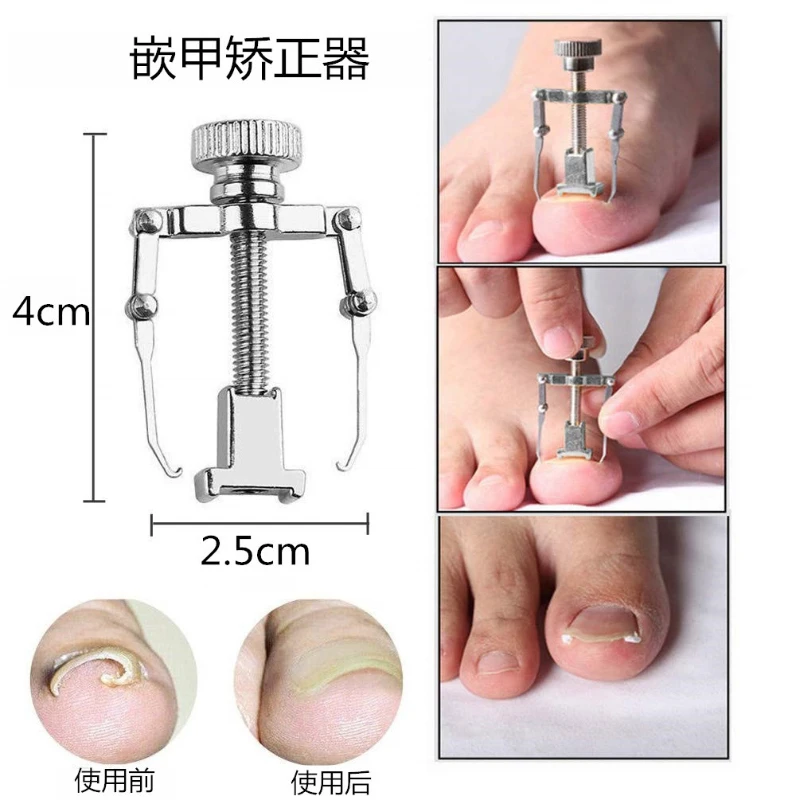 Toe Corrector Manicure Pedicure Tools Ingrown Toenail Straightening Clip Stainless Steel Treatment Onyxis Correction