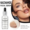 Niacinamide Spot Removal Essence Freckle Whitening Moisturizing Essence Water Dark Spot Melasma Removal Facial Skin Cream 2025 1