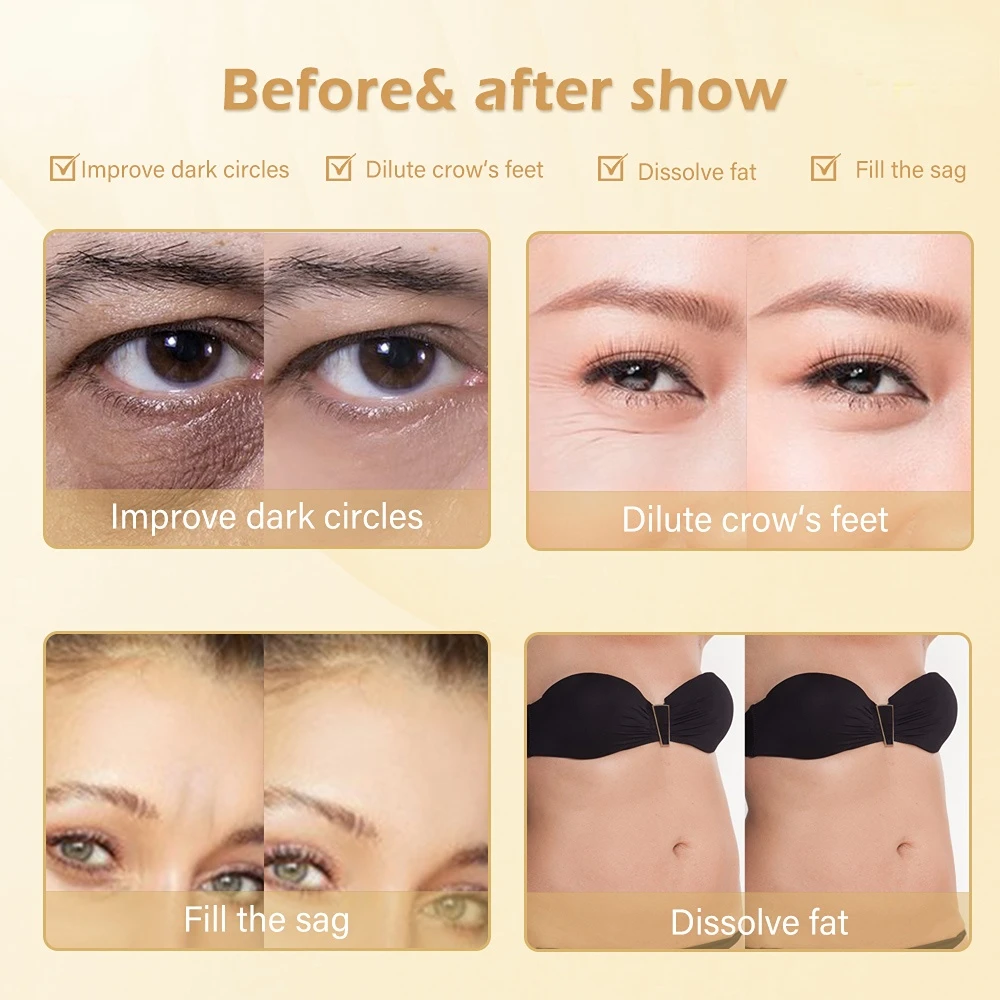 Рисунок 6 - Гиалуроновая ручка 2 в 1