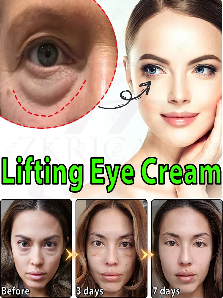 Eye cream anti wrinkle brightens and removes dark circles