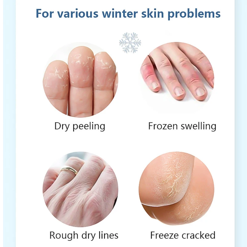 Foot Cream Herbal Anti Crack Foot Cream Oil Anti-Drying Crack Feet Cream Heel Cracked Repair Removal Bad Skin Hand Feet Care Mask