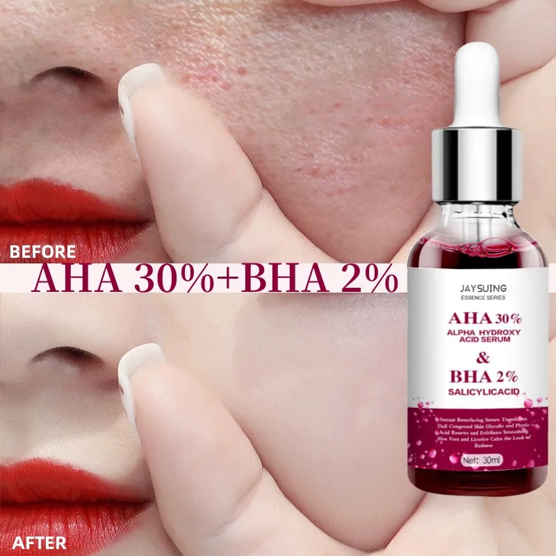 

AHA 30% Hyaluronic Acid Serum for Face Acne Treatment Removal Blackhead,Shrink Pores,Soften Skin,Brighten Skin Care Products