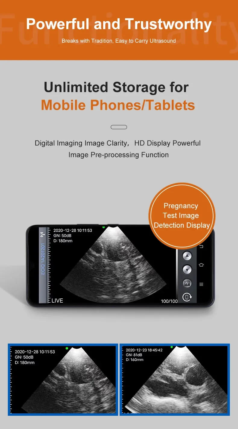 Handheld Ultrasound Machine Pig Sheep Wireless Mechanical Veterinary Ultrasound