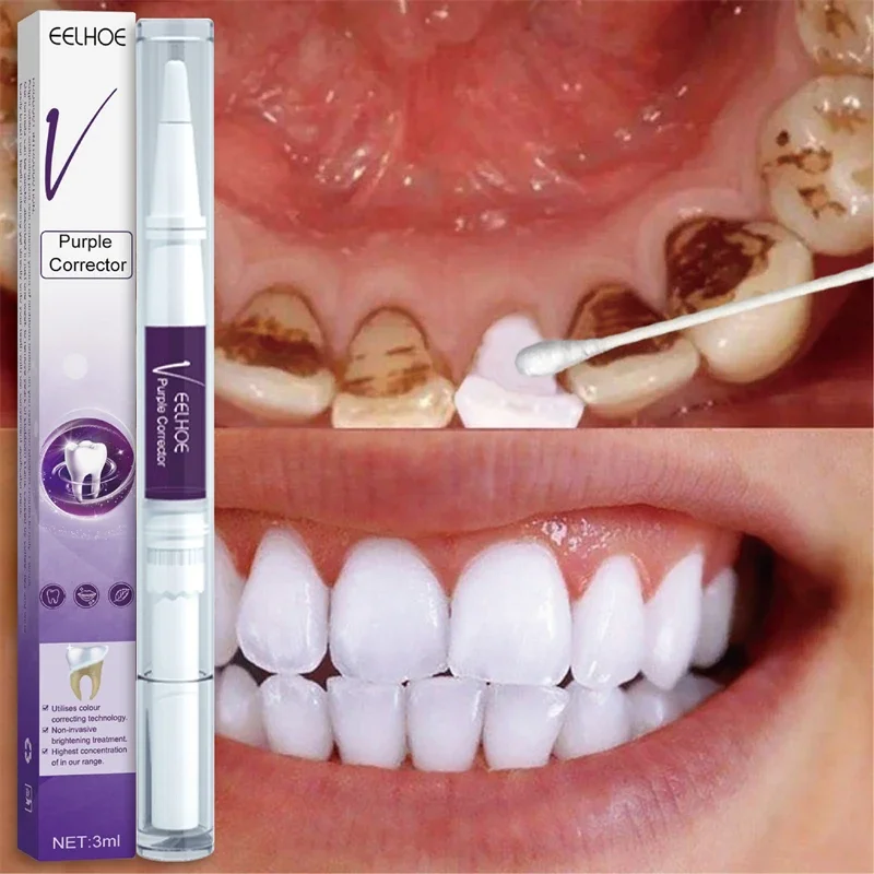 Teeth Whitening Pen Removes Plaque Stains Essence Tooth Bleaching Cleaning Serum White Teeth Oral Hygiene Tooth Whitening Care teeth whitening gel teeth whitening powder teeth whitening toothpaste teeth whitening kit teeth whitening strips