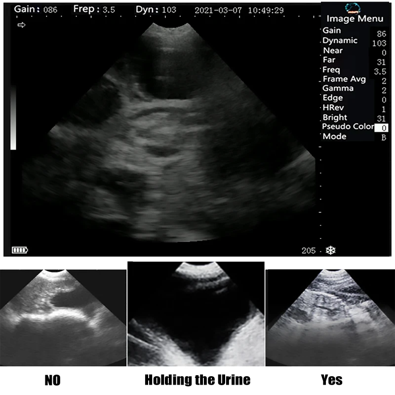 Veterinary Ultrasound Scanner Portable Pregnancy Testing For Cattle Cow Pig Sheep Horse Farm Animals Pet