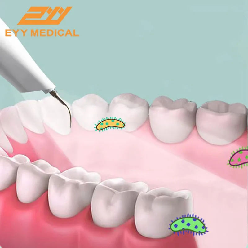 dentes scalerelectric dental limpeza ferramentas 01