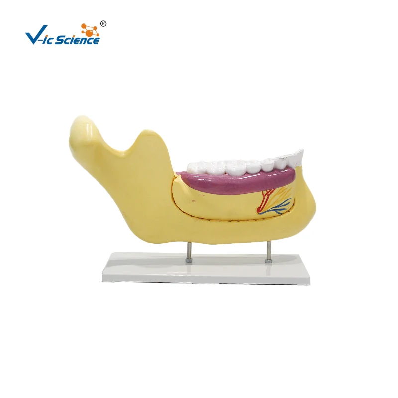 

Anatomical Model of Dentition and Molars