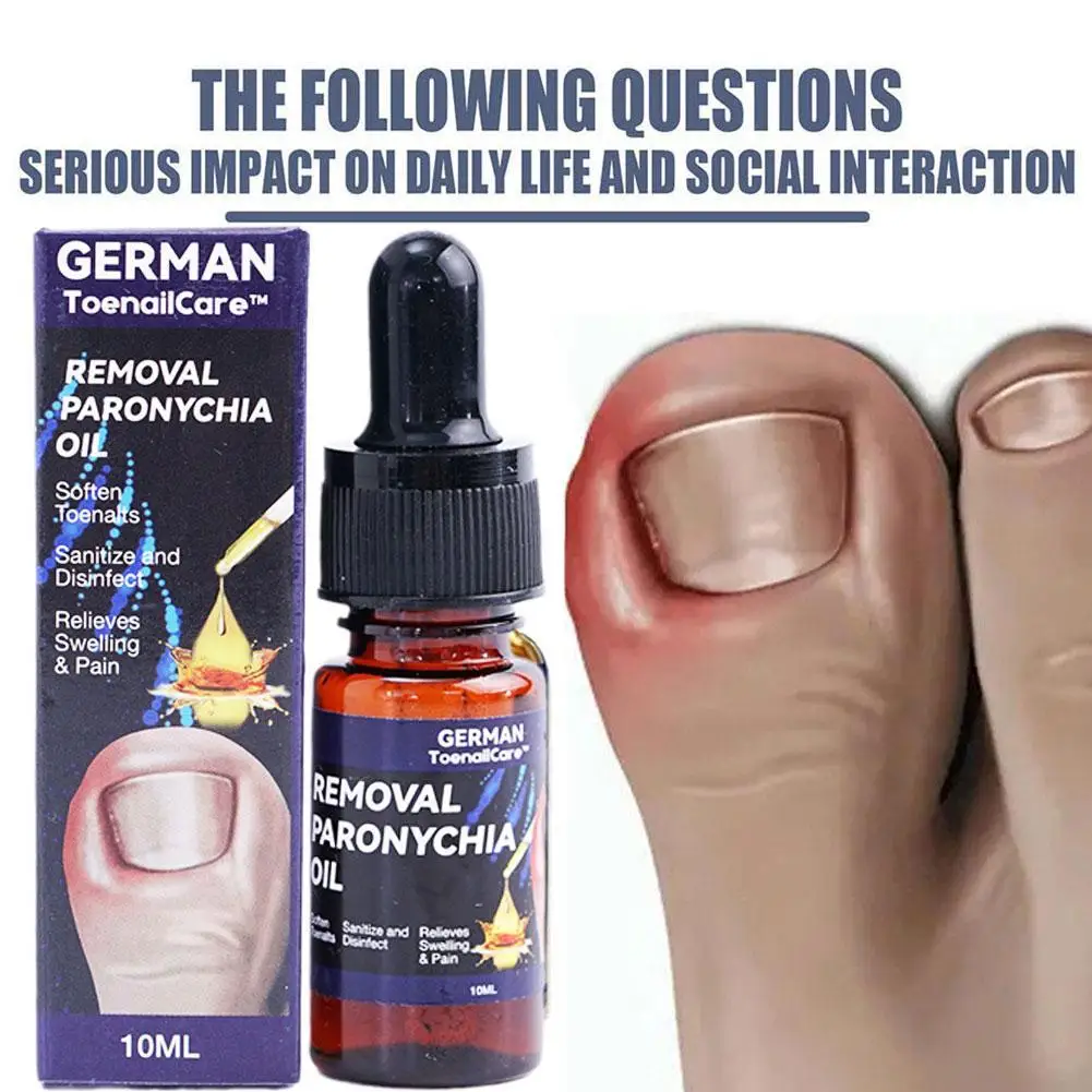 Nail Repair Essence Anti-nail Groove Fungus Removal Anti-onychomycosis Anti-foot Infection Repair Feet Nail Ingrown Nail Care